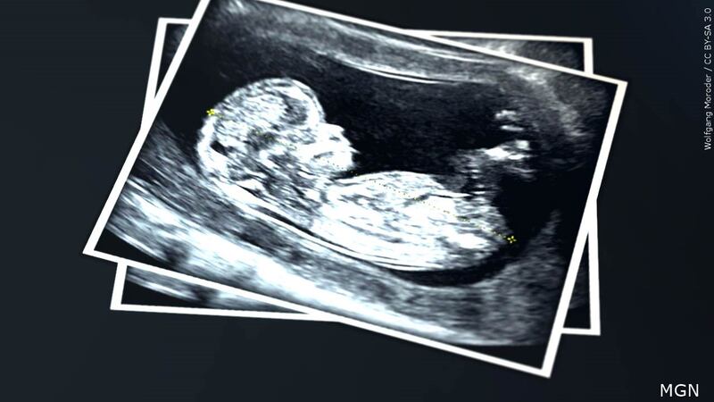 FILE PHOTO: Sonogram photo