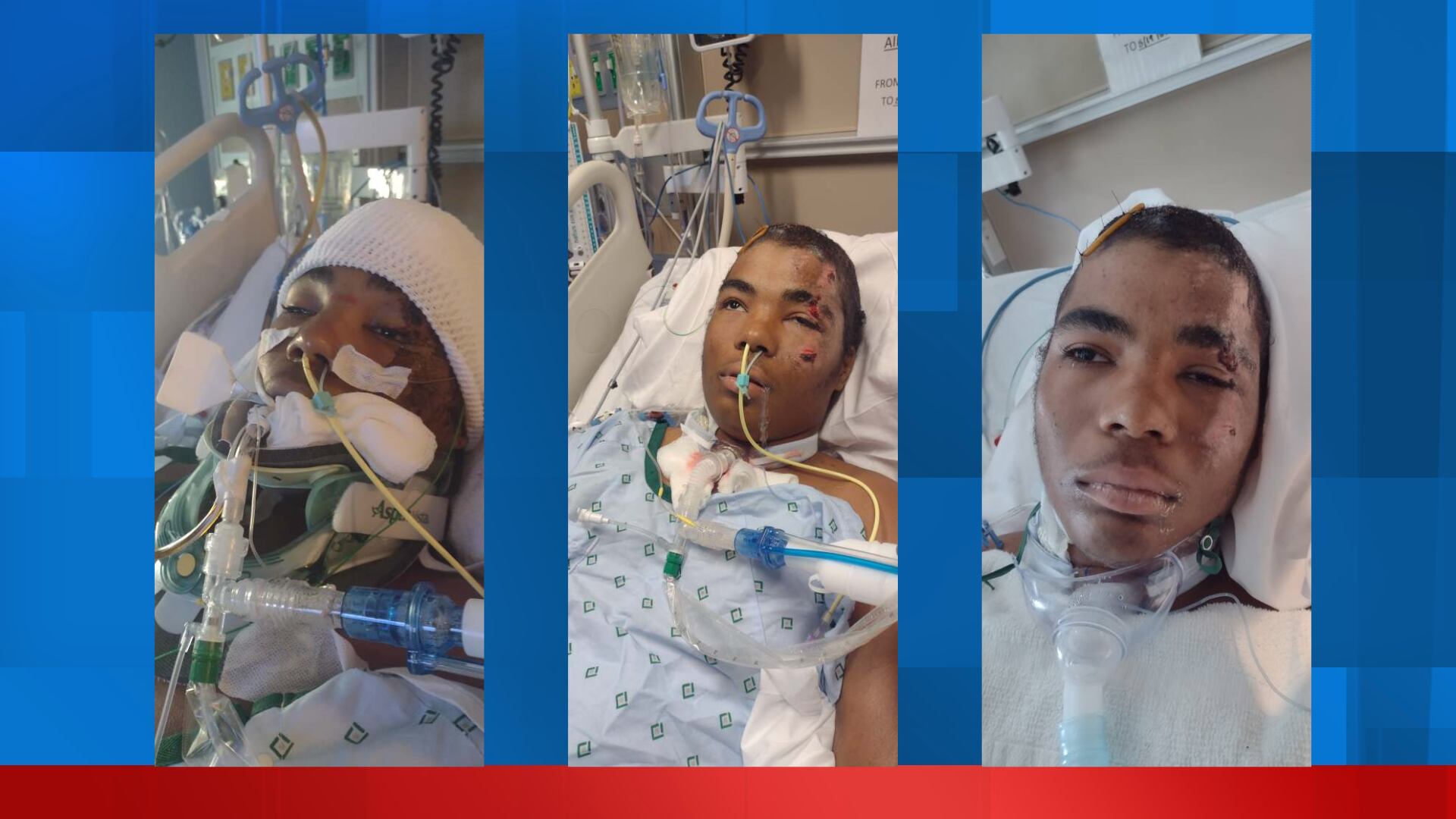 Valdosta teen remains in coma after being hit by car - Vimarsana News